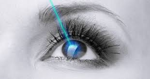 LASIK LASER EYE SURGERY IN JODHPUR